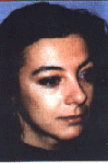 After Microdermabrasion